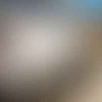 Enhancing Your Cleaning with Dry Ice: How to Choose the Right Dry Ice Cleaning Machine