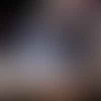 Stay Safe with Dry Ice: An Extensive Guide to Safety Precautions and Potential Burns